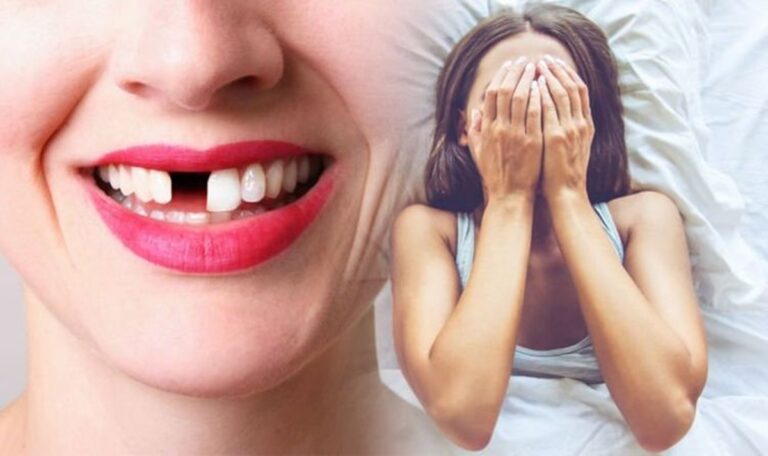 Sonhar com dente caindo: 10 significados surpreendentes sobre esse sonho
