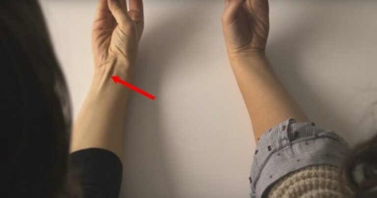 Se você também tem isso no antebraço, vai ficar perplexo ao saber o que significa
