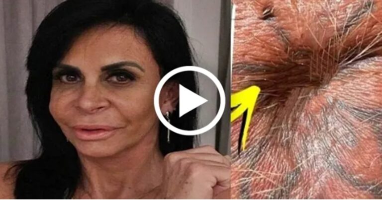 A estranha foto que Gretchen postou, imagem com foto curiosa de parte de seu corpo, aí vai uma foto de close dele