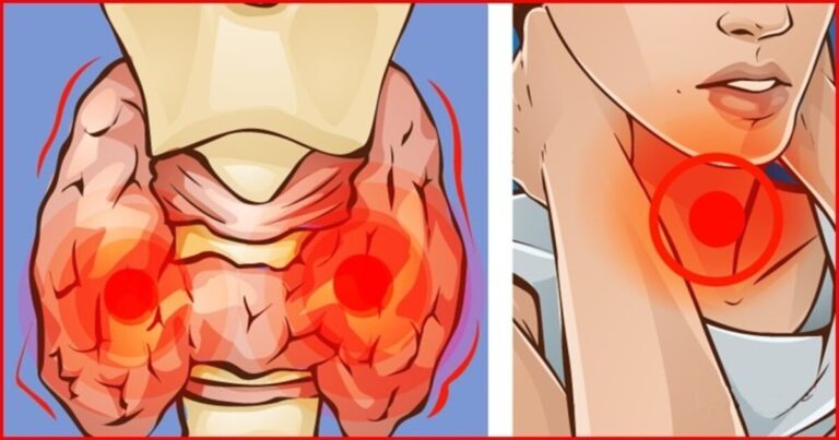 Não consuma mais esses 4 alimentos que afetam negativamente a tireoide