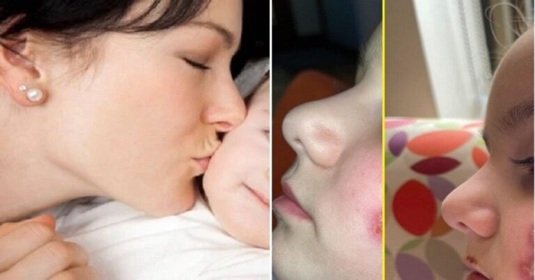 Beijo na face de criança pode trazer riscos: menina fica internada após contrair infecção da mãe; fique alerta
