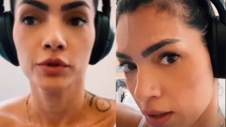 Em tratamento contra doença, Kelly Key preocupa fãs ao mostrar manchas espalhadas pelo corpo