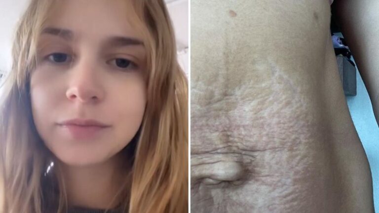 Isabella Scherer surpreende após exibir barriga real um mês após o parto dos gêmeos: “Mostrando a realidade”
