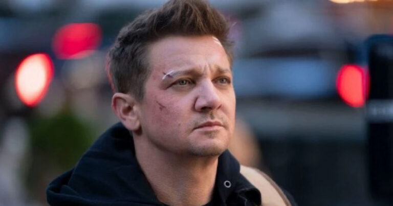 Jeremy Renner mostra o rosto pela primeira vez após acidente e se pronuncia: ‘esculhambado’