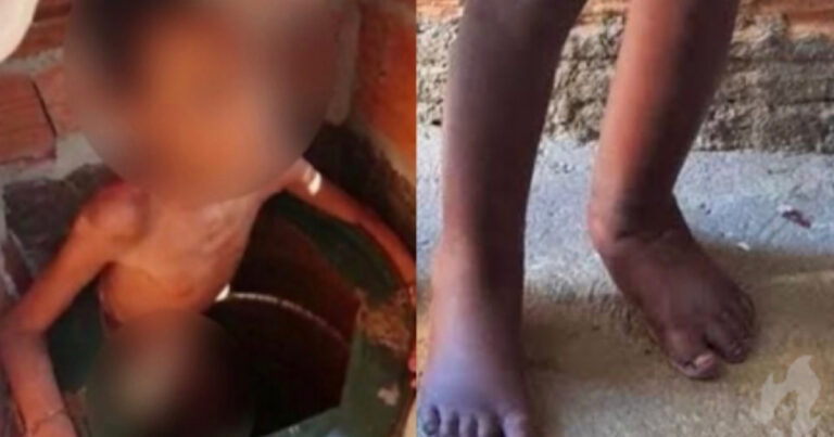 Lembra do menino acorrentado em barril? Segure a emoção ao saber como ele está 2 anos depois