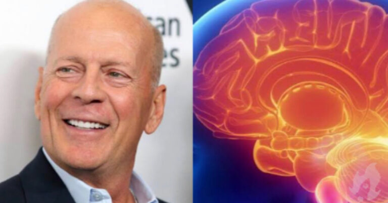 Com diagnóstico de demência, vídeo do ator Bruce Willis repercute e emociona os fãs: ‘Nada pode me derrubar’