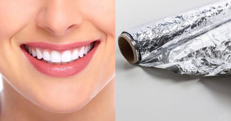 Como clarear os dentes com papel alumínio?