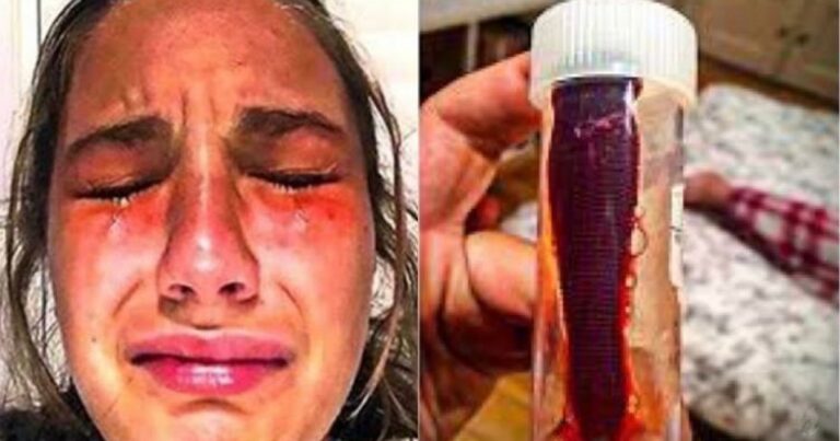 Mulher vai ao médico reclamando de coceira no nariz, mas ao descobrir o que era fica surpresa – vídeo