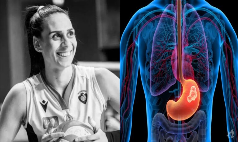 Os sintomas do câncer que tirou a vida da jogadora de vôlei Paula Borgo