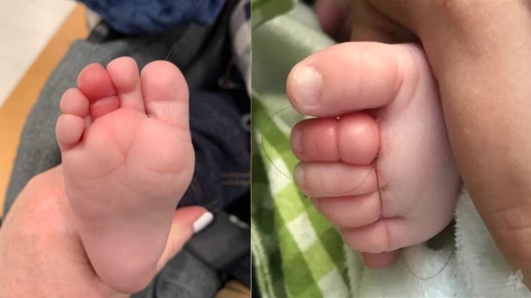 Por que você deve checar os pés dos bebês que choram sem motivo aparente