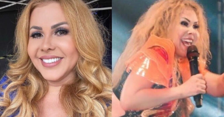Cantora Joelma assusta com rosto inchado novamente e detalhe preocupa os fãs
