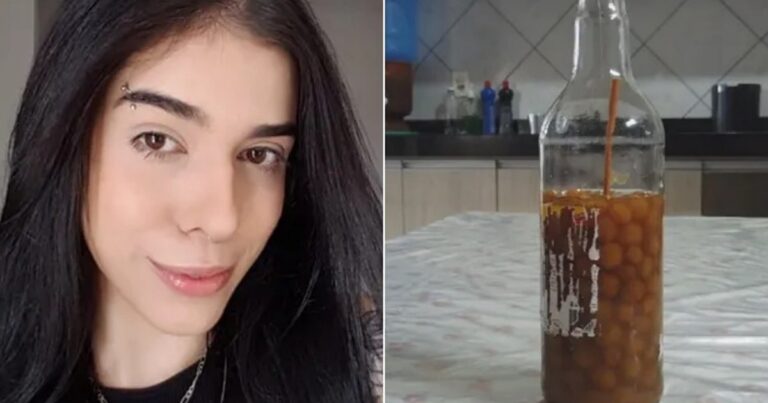 Jovem internada após cheirar pimenta tem novas infecções e volta para casa é adiada