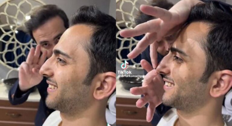 Resultado de rinoplastia em paciente viraliza na internet, vídeo