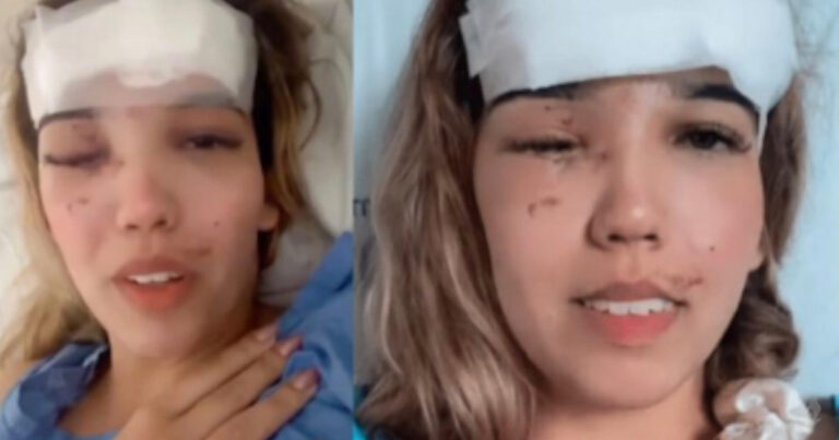 Mulher de 25 anos sobrevive após fraturar o crânio a caminho do velório