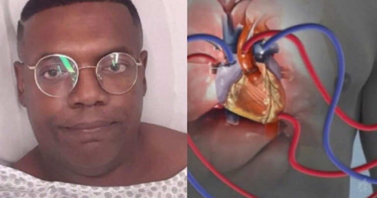 Coração artificial: entenda procedimento que mantém MC Marcinho vivo após 14 minutos de parada cardíaca