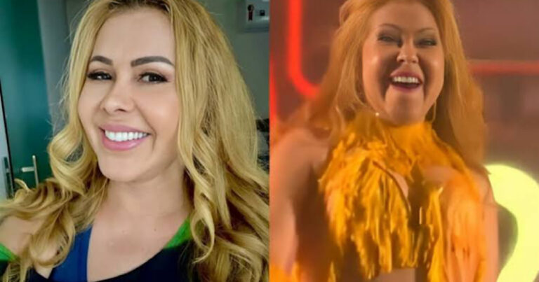 Joelma recebe diagnóstico de doença que deixou seu rosto deformado