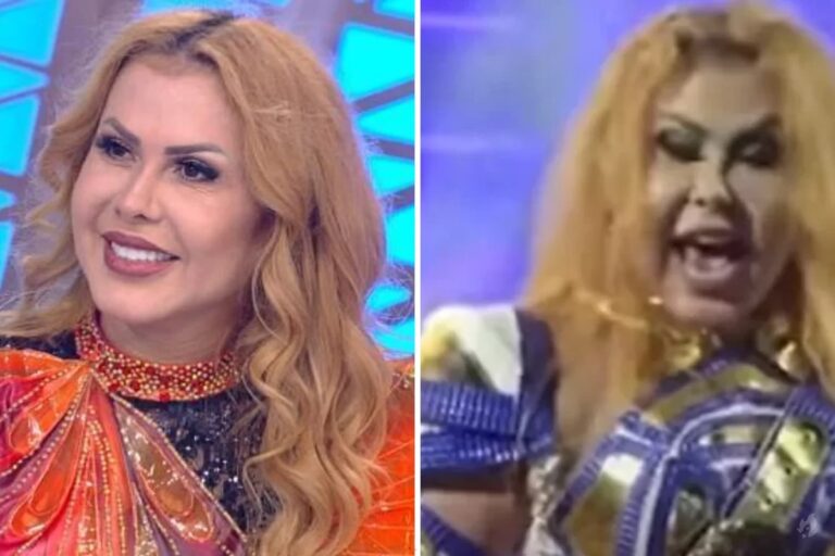 Diagnóstico detalha mal-estar de Joelma em show e inchaços no rosto