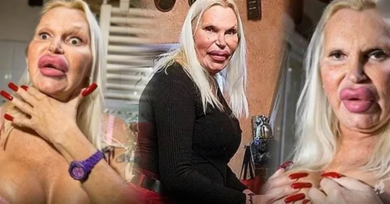 Ela gastou 300 MIL em cirurgias, para ter um rosto perfeito