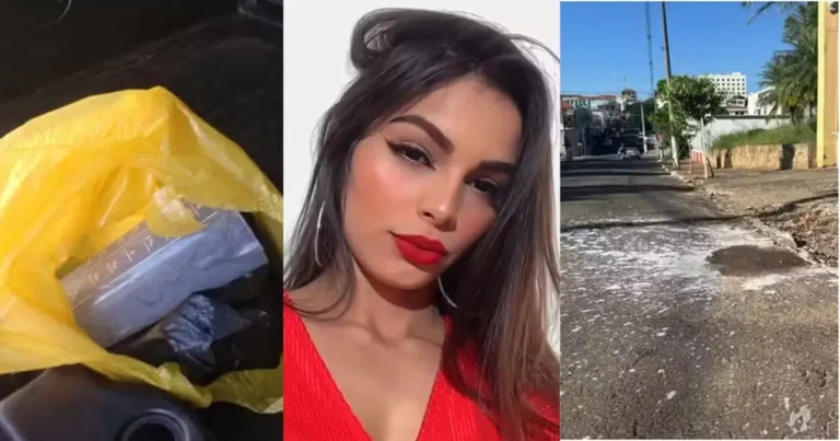 Jovem atacada com soda cáustica fala pela primeira vez e conta como tudo aconteceu ‘Sequelas’