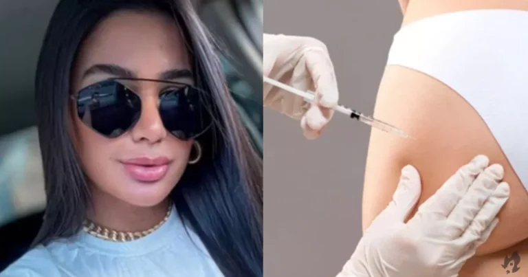 Conheça o PMMA: Produto Estético que Resultou na trágica Morte da Influencer de 33 Anos