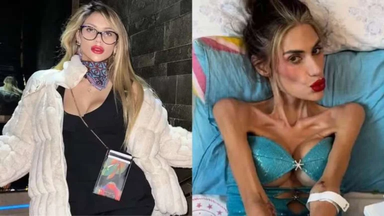 Influenciadora morre após luta contra distúrbio grave que a deixou com 22,5 kg