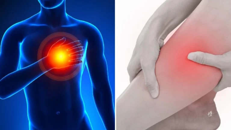 Esse sintomas na perna pode indicar que você está prestes a ter um infarto