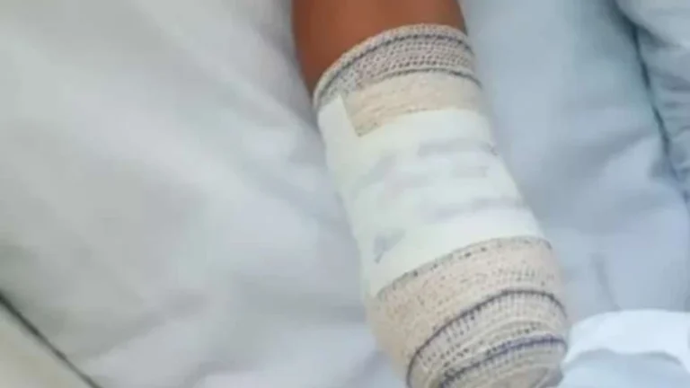 Menino de 8 anos sofre amputações após confusão entre bomba e peça de bicicleta no Rio