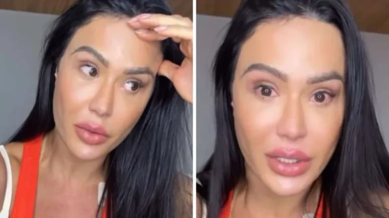 Gracyanne Barbosa chora ao relembrar da dor após lesão: Ouvi um estalo muito alto