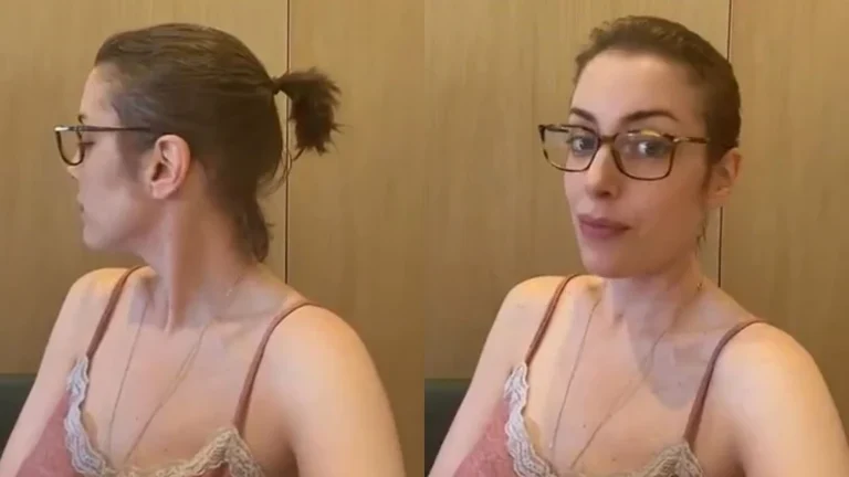 Após tratamento contra o câncer, Fabiana Justus comemora o crescimento do cabelo