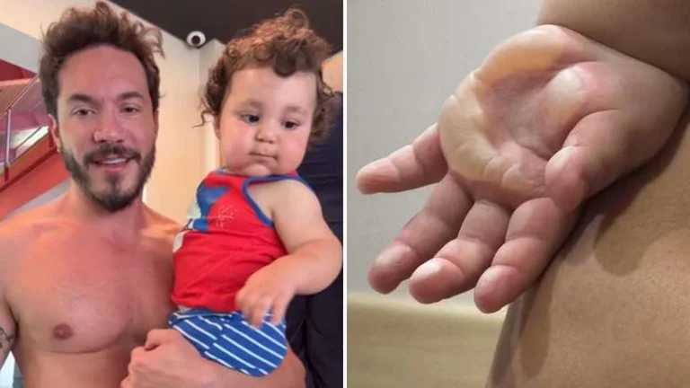 Eliezer atualiza recuperação do filho após cirurgia de emergência: Guerreiro