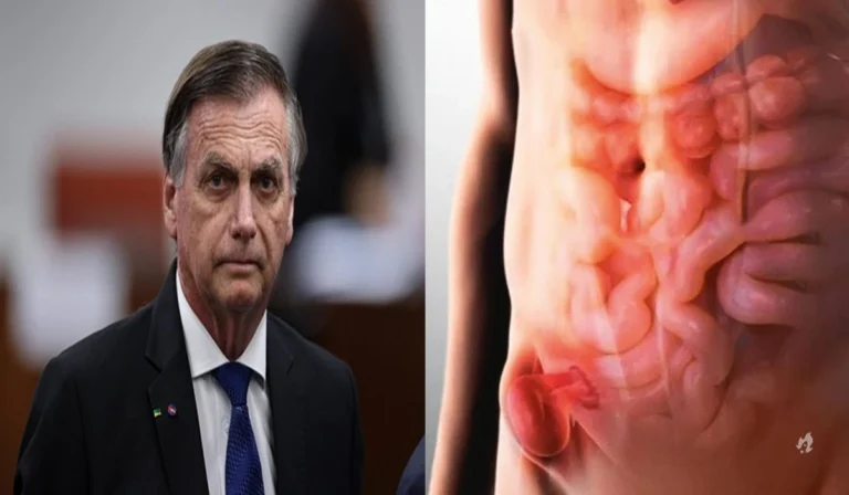 Saiba detalhes de cirurgia de hérnia inguinal que será realizada em Bolsonaro