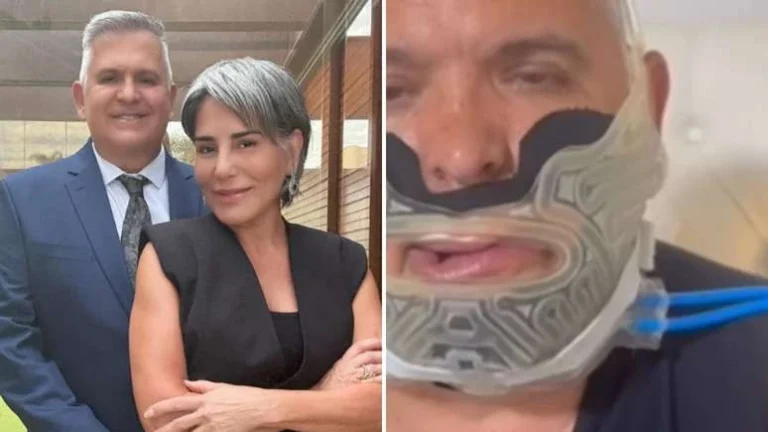 Marido de Gloria Pires surge irreconhecível após fazer cirurgia de risco: Difícil recuperação