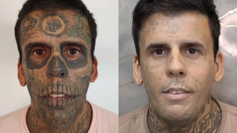 “Mais tatuado do Brasil” passa por nova remoção e fala em vida missionária
