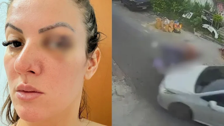Vereadora que atropelou namorado após agressão se pronuncia nas redes