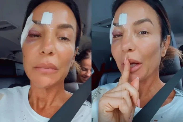 Ivete Sangalo atualiza estado de saúde após desmaio e internação. Veja o vídeo