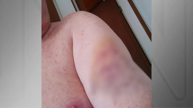 Polícia Civil indicia dentista por agredir idoso no trânsito no ES