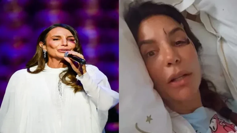 Após acidente, Ivete Sangalo rompe o silêncio e revela informação que preocupa o Brasil: “Neste domingo”
