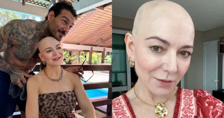 Mãe de Lucas Lucco mostra cabeça raspada após diagnóstico de alopecia