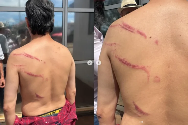 Vereador do PT preso em ato do MST acusa PMGO de agressão física