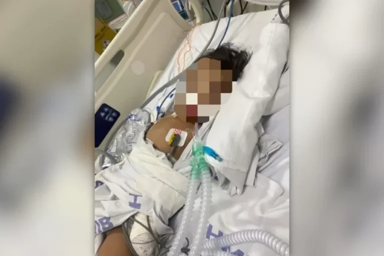Criança de 1 ano picada por escorpião no DF está internada em UTI. Veja vídeo