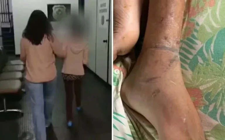 GO: filho acorrentado pela mãe teve 3 AVCs e ficou dias sem comida