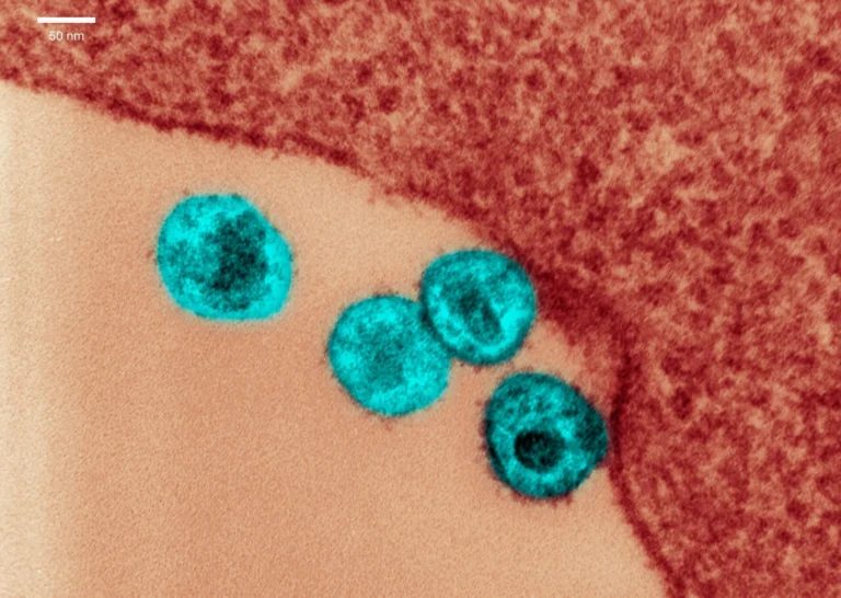 Condenação por transmissão de HIV em SC: entenda os direitos e deveres