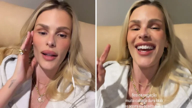 Yasmin Brunet relata crise de lipedema após comer glúten; entenda