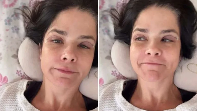 SUSTO! Samara Felippo aparece acamada e cheia de curativos: