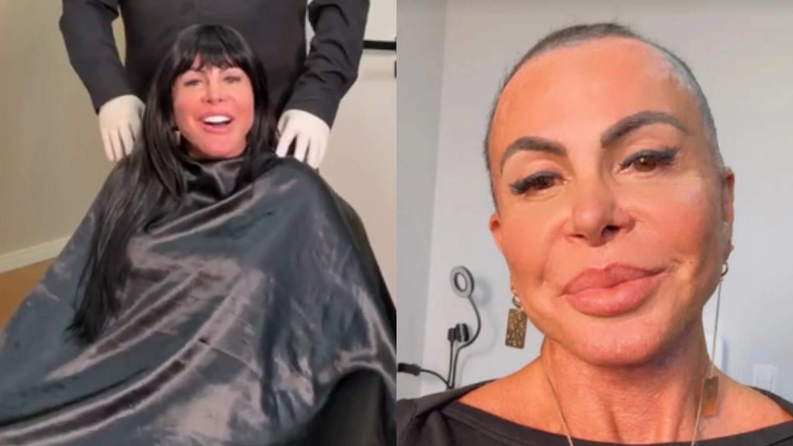 Antes de começar transplante capilar, Gretchen raspa cabeça em live; veja